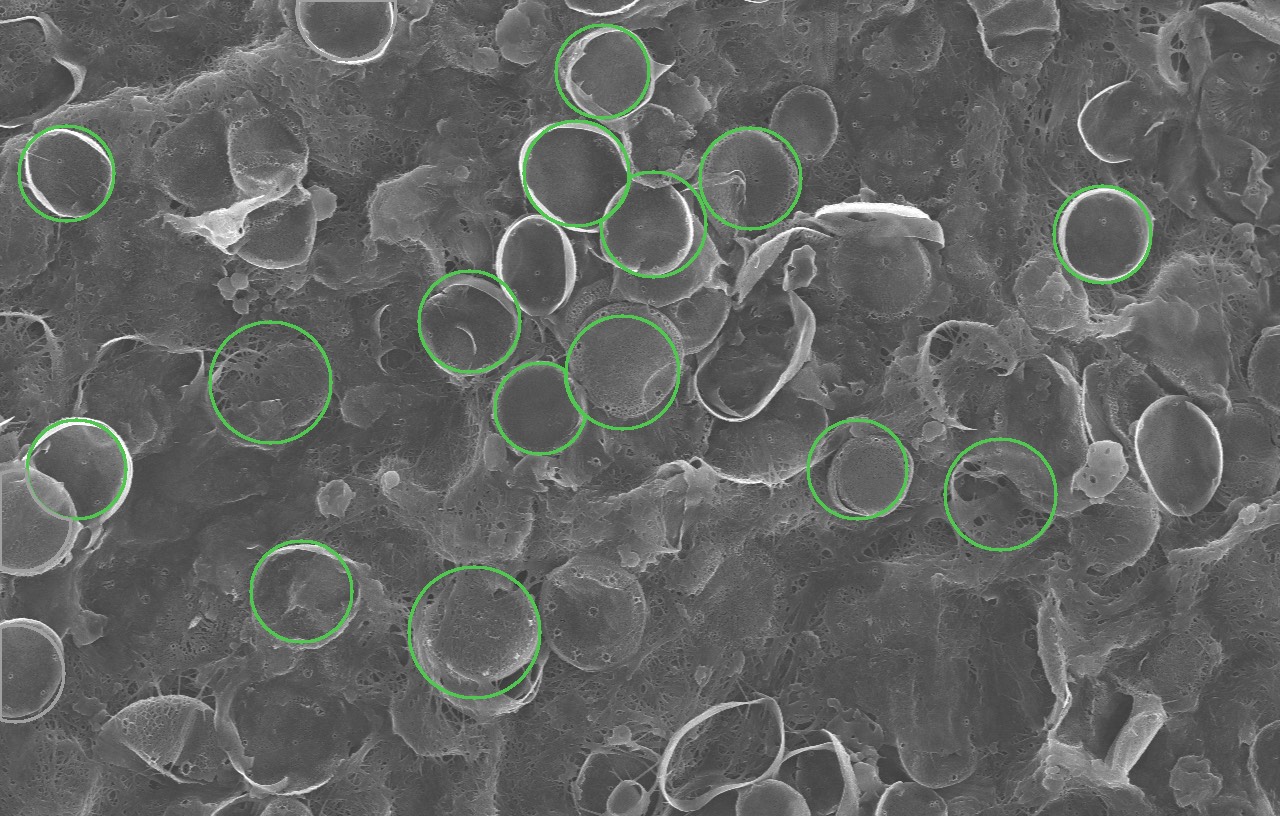A grey electron-microscope image of small round algae shells. Eighteen are outlined in green where DiatoMeter found and measured them.